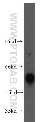 PRPF19 Antibody in Western Blot (WB)