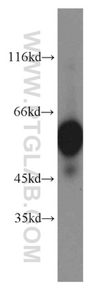 PRPF19 Antibody in Western Blot (WB)