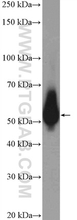 PRPF19 Antibody in Western Blot (WB)