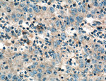 ANXA9 Antibody in Immunohistochemistry (Paraffin) (IHC (P))