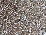 BDH1 Antibody in Immunohistochemistry (Paraffin) (IHC (P))