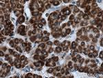 BDH1 Antibody in Immunohistochemistry (Paraffin) (IHC (P))