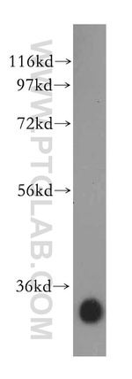 BDH1 Antibody in Western Blot (WB)