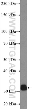 BDH1 Antibody in Western Blot (WB)