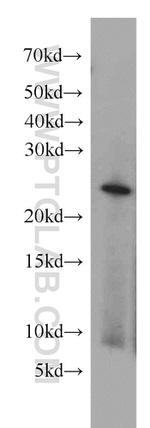 RAB2 Antibody in Western Blot (WB)