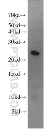 RAB2 Antibody in Western Blot (WB)