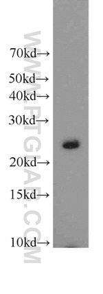 RAB2 Antibody in Western Blot (WB)