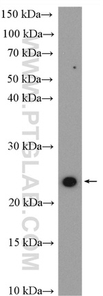 RAB2 Antibody in Western Blot (WB)