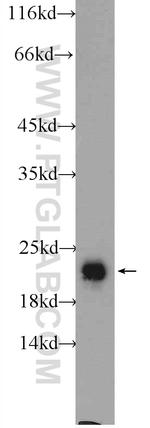 RAB2 Antibody in Western Blot (WB)