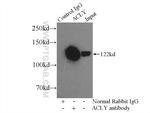 ATP citrate lyase Antibody in Immunoprecipitation (IP)