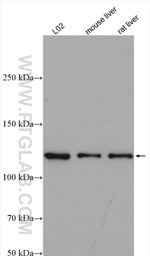 ATP citrate lyase Antibody in Western Blot (WB)