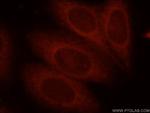 Bif-1 Antibody in Immunocytochemistry (ICC/IF)