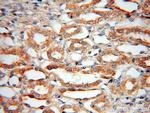 Bif-1 Antibody in Immunohistochemistry (Paraffin) (IHC (P))