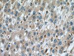 Alpha galactosidase A Antibody in Immunohistochemistry (Paraffin) (IHC (P))