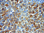 Alpha galactosidase A Antibody in Immunohistochemistry (Paraffin) (IHC (P))