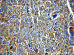 Alpha galactosidase A Antibody in Immunohistochemistry (Paraffin) (IHC (P))