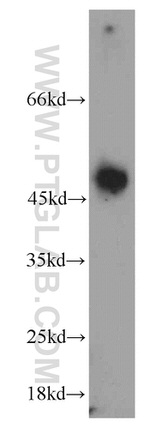 Alpha galactosidase A Antibody in Western Blot (WB)