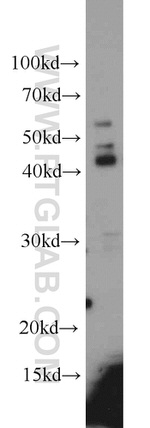 Alpha galactosidase A Antibody in Western Blot (WB)