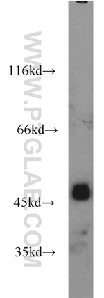 Alpha galactosidase A Antibody in Western Blot (WB)