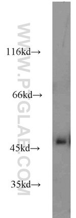 Alpha galactosidase A Antibody in Western Blot (WB)