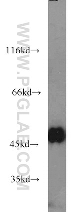 Alpha galactosidase A Antibody in Western Blot (WB)