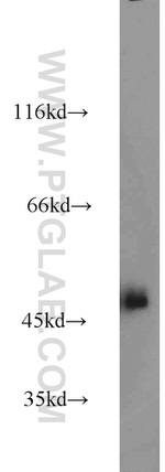 Alpha galactosidase A Antibody in Western Blot (WB)