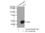 Alpha galactosidase A Antibody in Immunoprecipitation (IP)