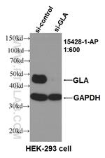 Alpha galactosidase A Antibody in Western Blot (WB)