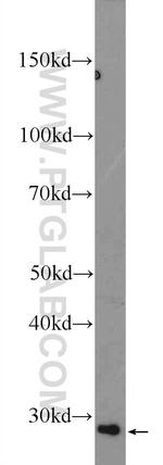 PPT2 Antibody in Western Blot (WB)