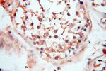 CA11 Antibody in Immunohistochemistry (Paraffin) (IHC (P))