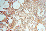 CA11 Antibody in Immunohistochemistry (Paraffin) (IHC (P))