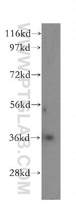 CA11 Antibody in Western Blot (WB)