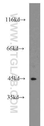 STK32B Antibody in Western Blot (WB)