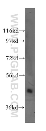 STK32B Antibody in Western Blot (WB)