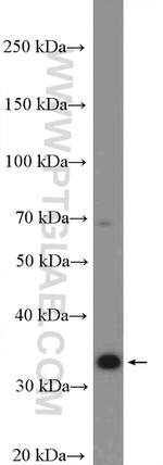 AKR1B1 Antibody in Western Blot (WB)