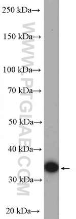 AKR1B1 Antibody in Western Blot (WB)