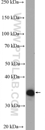 AKR1B1 Antibody in Western Blot (WB)