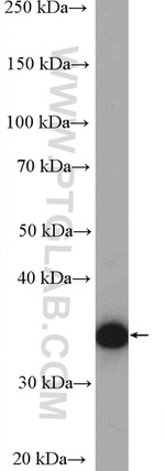 AKR1B1 Antibody in Western Blot (WB)