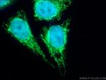 LONP1 Antibody in Immunocytochemistry (ICC/IF)