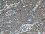 LONP1 Antibody in Immunohistochemistry (Paraffin) (IHC (P))