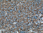 LONP1 Antibody in Immunohistochemistry (Paraffin) (IHC (P))