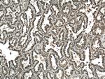 LONP1 Antibody in Immunohistochemistry (Paraffin) (IHC (P))