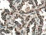 LONP1 Antibody in Immunohistochemistry (Paraffin) (IHC (P))