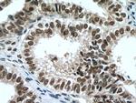 PAF1 Antibody in Immunohistochemistry (Paraffin) (IHC (P))