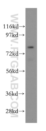 PAF1 Antibody in Western Blot (WB)