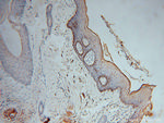 NSUN5 Antibody in Immunohistochemistry (Paraffin) (IHC (P))