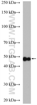 NSUN5 Antibody in Western Blot (WB)