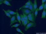 FA2H Antibody in Immunocytochemistry (ICC/IF)