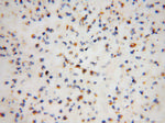 FA2H Antibody in Immunohistochemistry (Paraffin) (IHC (P))