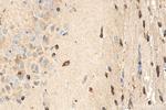 FA2H Antibody in Immunohistochemistry (Paraffin) (IHC (P))